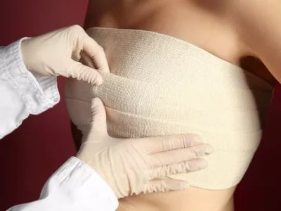 Bauchdeckenstraffung und Diät: Was Sie wissen müssen